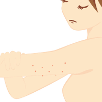 二の腕のぶつぶつ