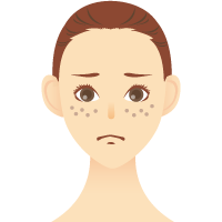 シミ・肝斑・そばかす・あざ